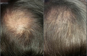 Comparison of a client before and after the Stop & Grow application