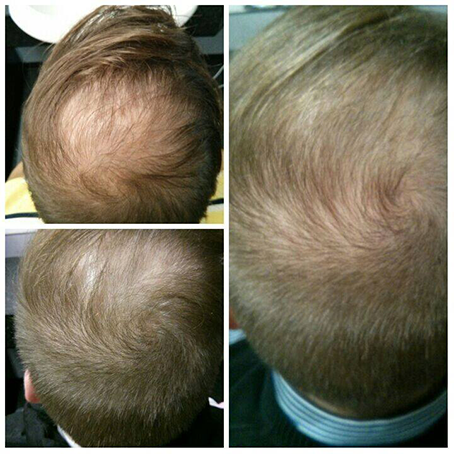 Comparison of a client before and after the Stop & Grow application